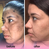 ALLUREY TURMERIC & KOJIC ACID PADS